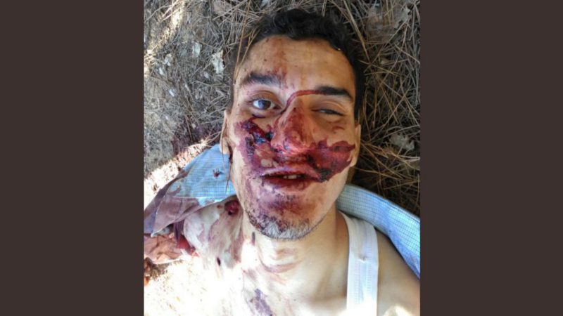 EL TERRORISTA DE BARCELONA Younes Abouyaaqoub, abatido por los Mossos en Subirats Terrorista-abatido