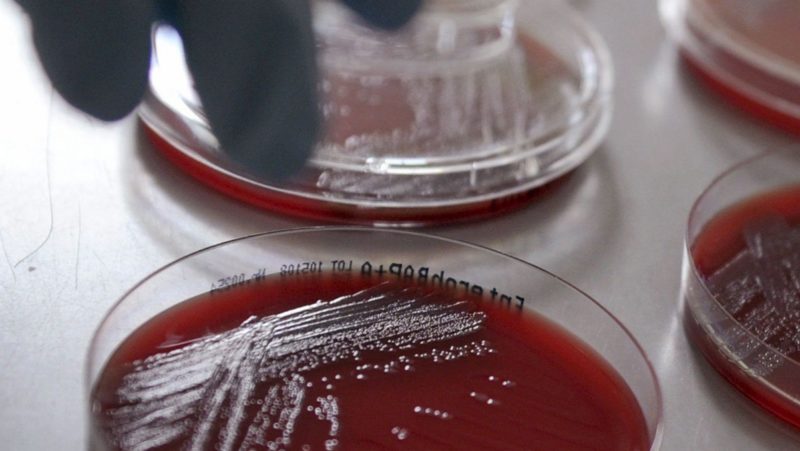 EEUU reconoce 221 casos de las peligrosas 'bacterias pesadilla'