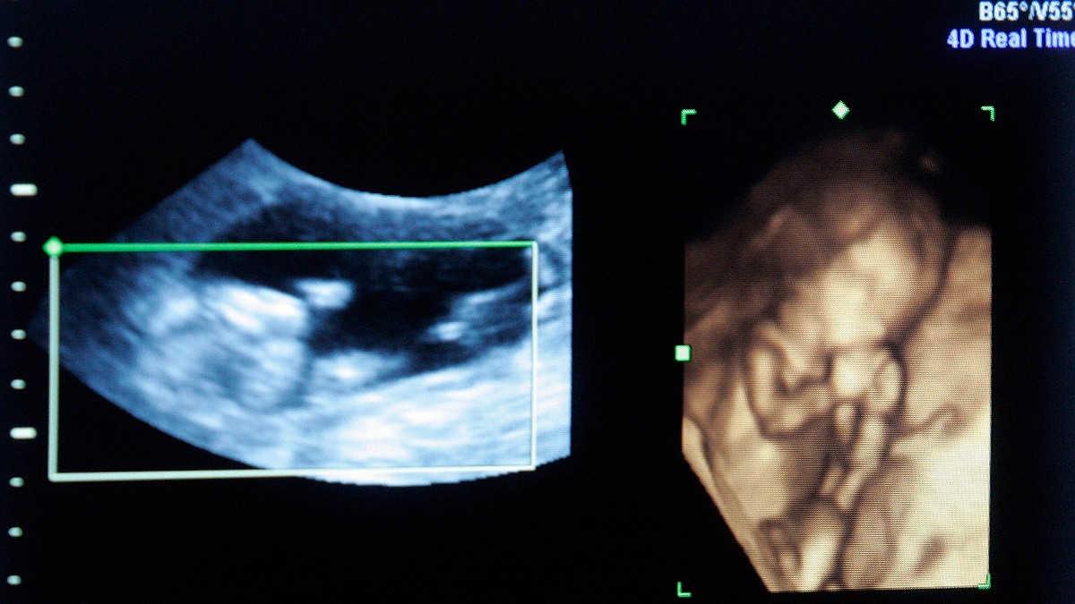 VOX defiende la vida: vota en la UE en contra de convertir el aborto en un ‘nuevo derecho humano’