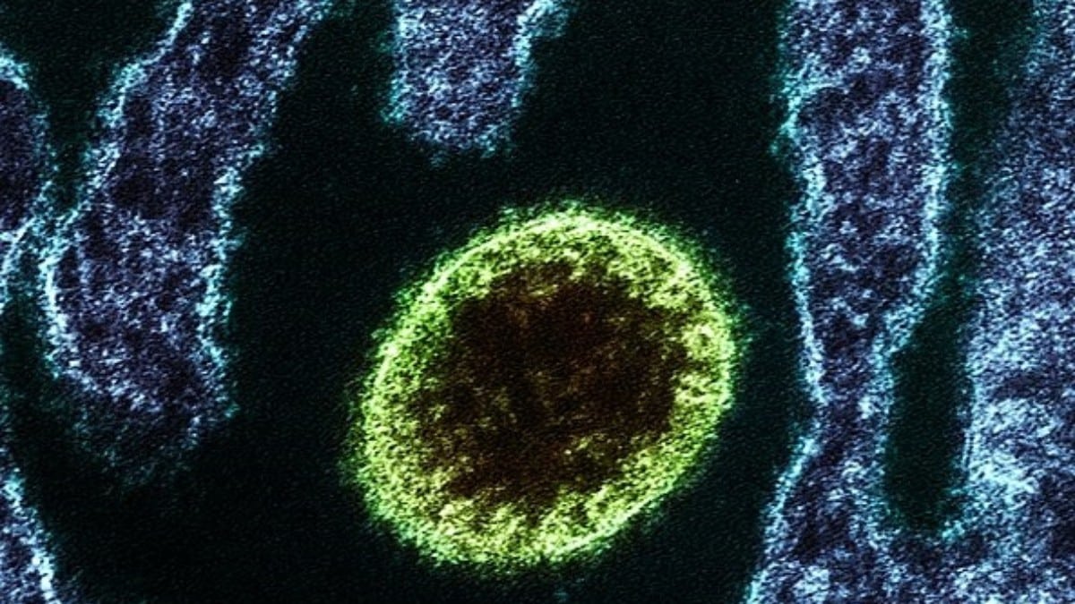 Un nuevo virus de origen animal infecta a 35 personas en China