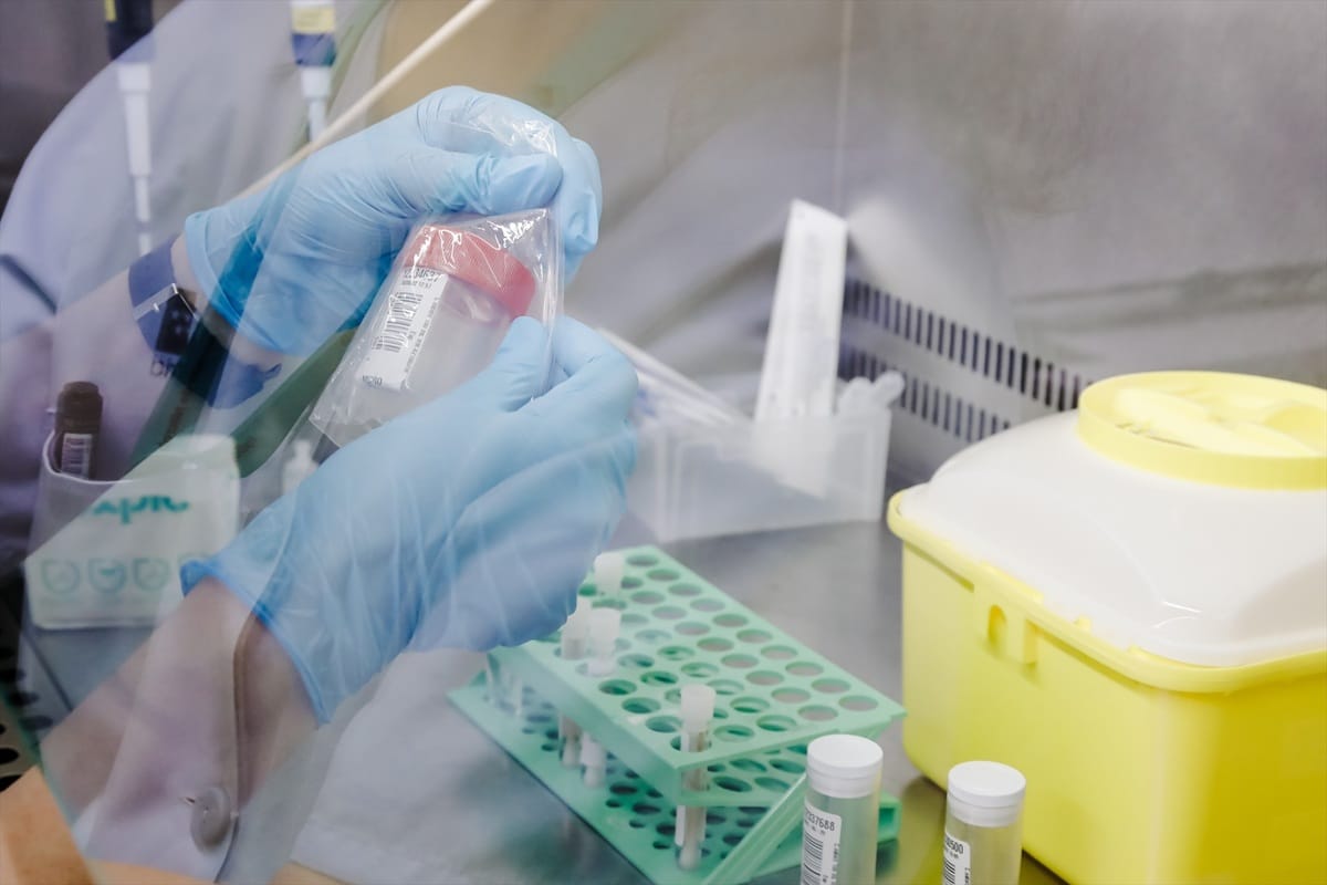 Detectado en Cantabria el primer caso de viruela del mono en el último año y medio