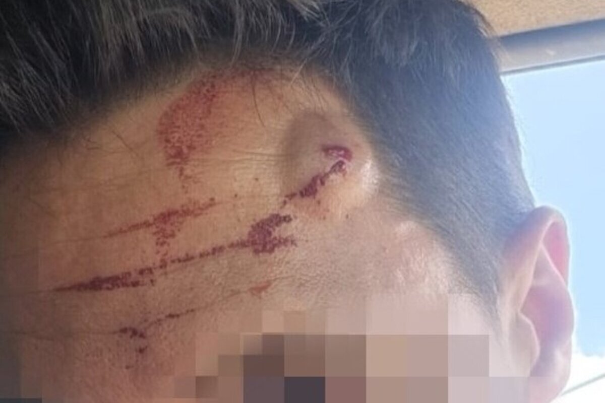 Un inmigrante ilegal agrede y hiere brutalmente a un guardia civil que trató de evitar que saltase la valla de Ceuta