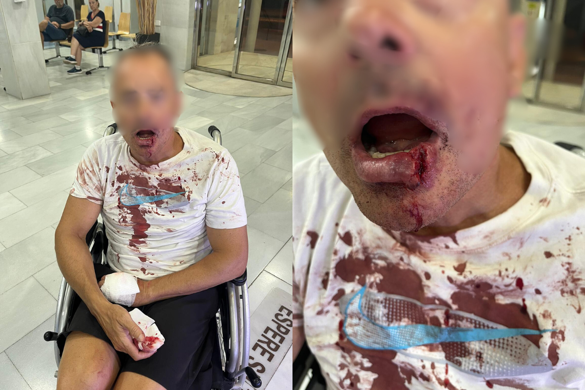 Así dejaron una banda de magrebíes a un señor que paseaba con su mujer en Torre Pacheco: «Intentaron matarlo»