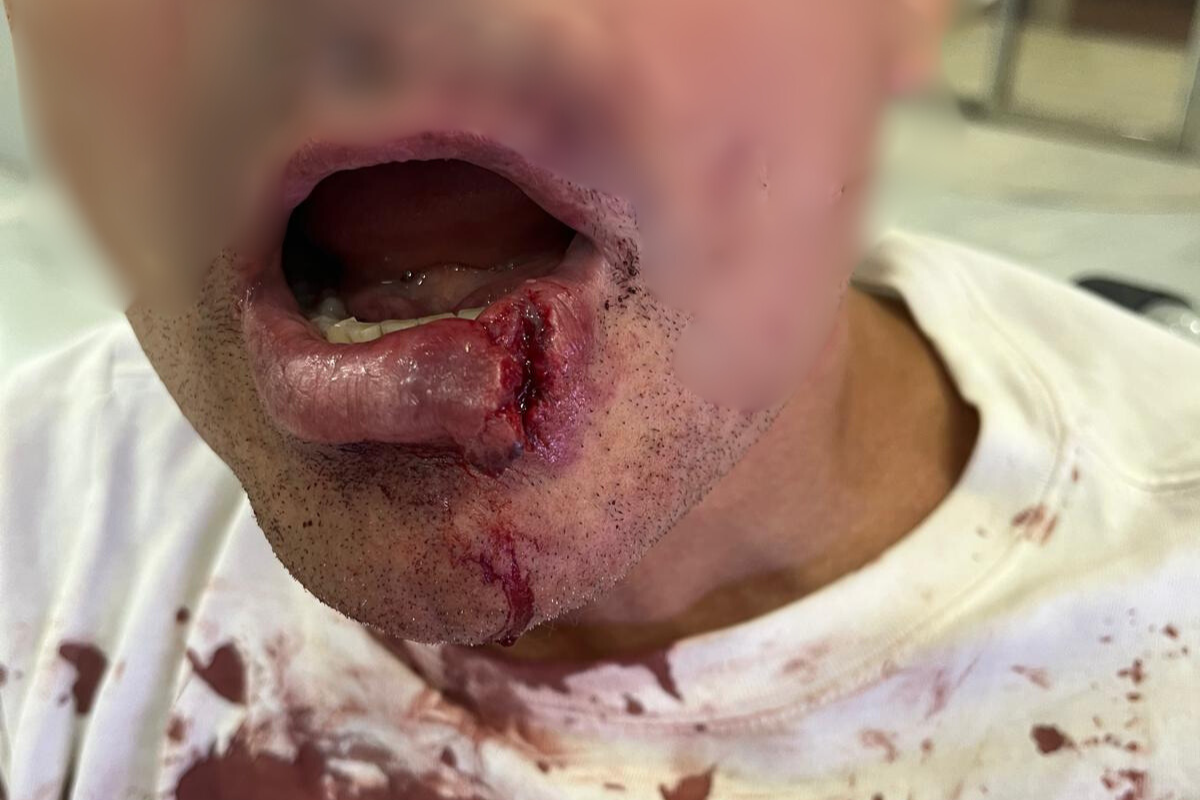Así dejaron una banda de magrebíes a un señor que paseaba con su mujer en Torre Pacheco: «Intentaron matarlo»