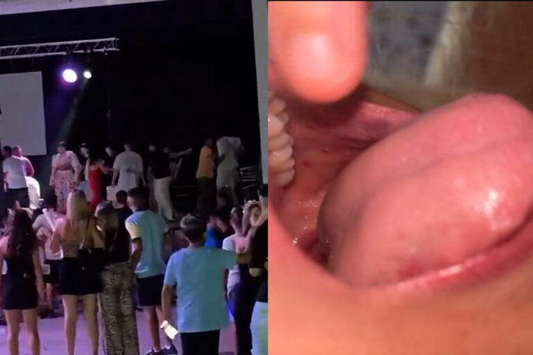 Un marroquí da varios puñetazos y envía al hospital a dos mujeres en las fiestas de Molvízar (Granada) por pedirle que bajase del escenario