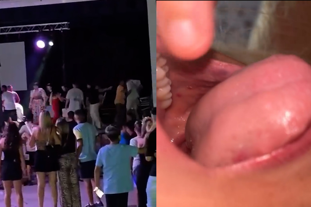 Un marroquí da varios puñetazos y envía al hospital a dos mujeres en las fiestas de Molvízar (Granada) por pedirle que bajase del escenario