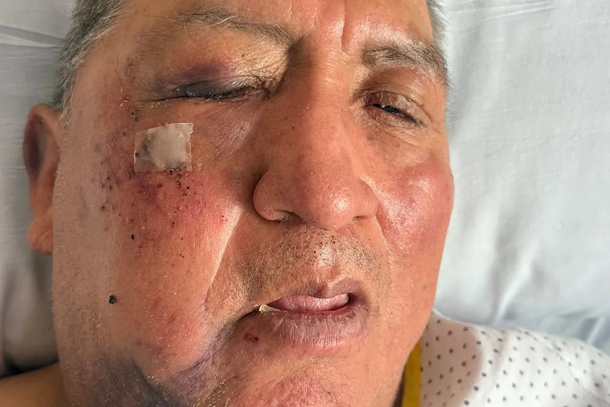 El anciano con parkinson que recibió una paliza en Parla que le rompió la mandíbula habla un mes después: «Entre ellos se comunicaban en árabe»
