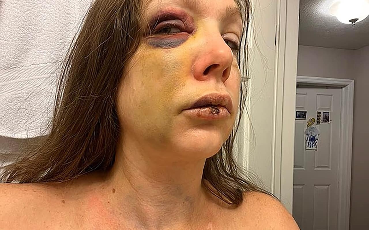 Tres afroamericanos agreden con brutalidad a una mujer en un festival de Jazz en Cincinnati: las autoridades apuntan a una motivación racial