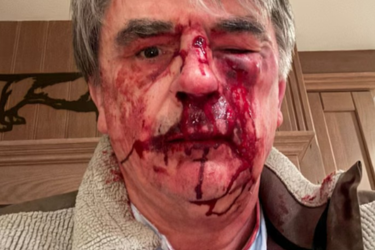 Brutal agresión animalista al presidente de la federación de caza de Flandes: tiene múltiples golpes y fracturada la cara