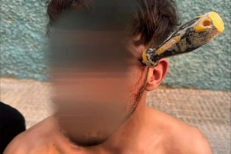 Brutal reyerta entre un marroquí y un argelino en Alicante: uno de ellos acaba con un destornillador incrustado en el cráneo