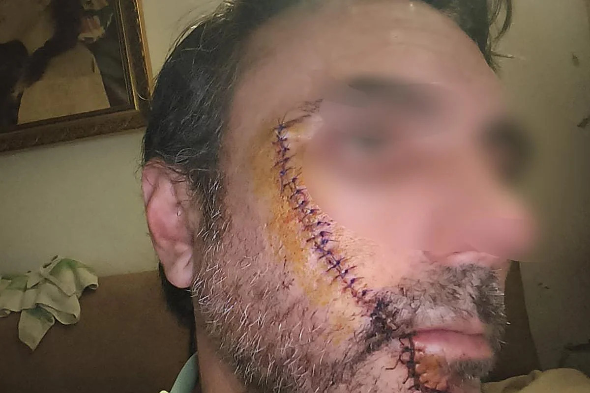 Un inmigrante marroquí raja la cara a un hombre por afearle que golpeara coches y mobiliario urbano en Málaga
