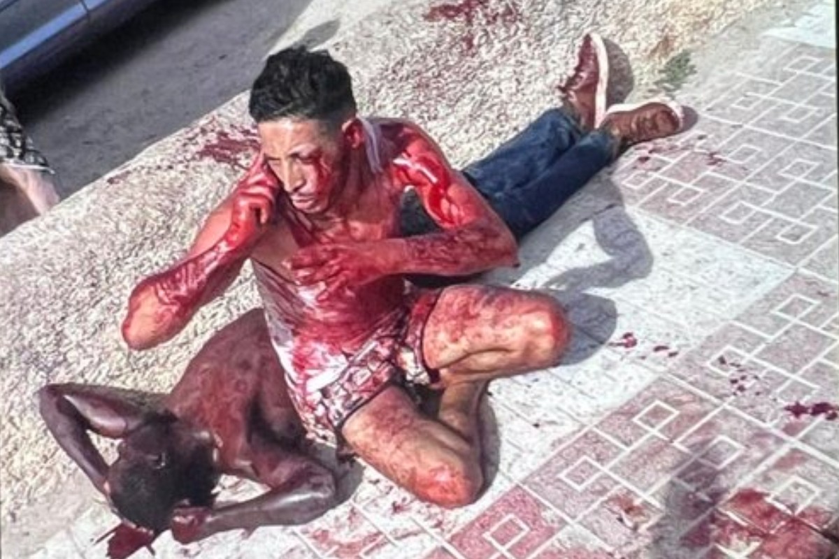 Un magrebí revienta la cabeza con un martillo a un vecino de Torre Pacheco y raja el cuello a otro con una botella