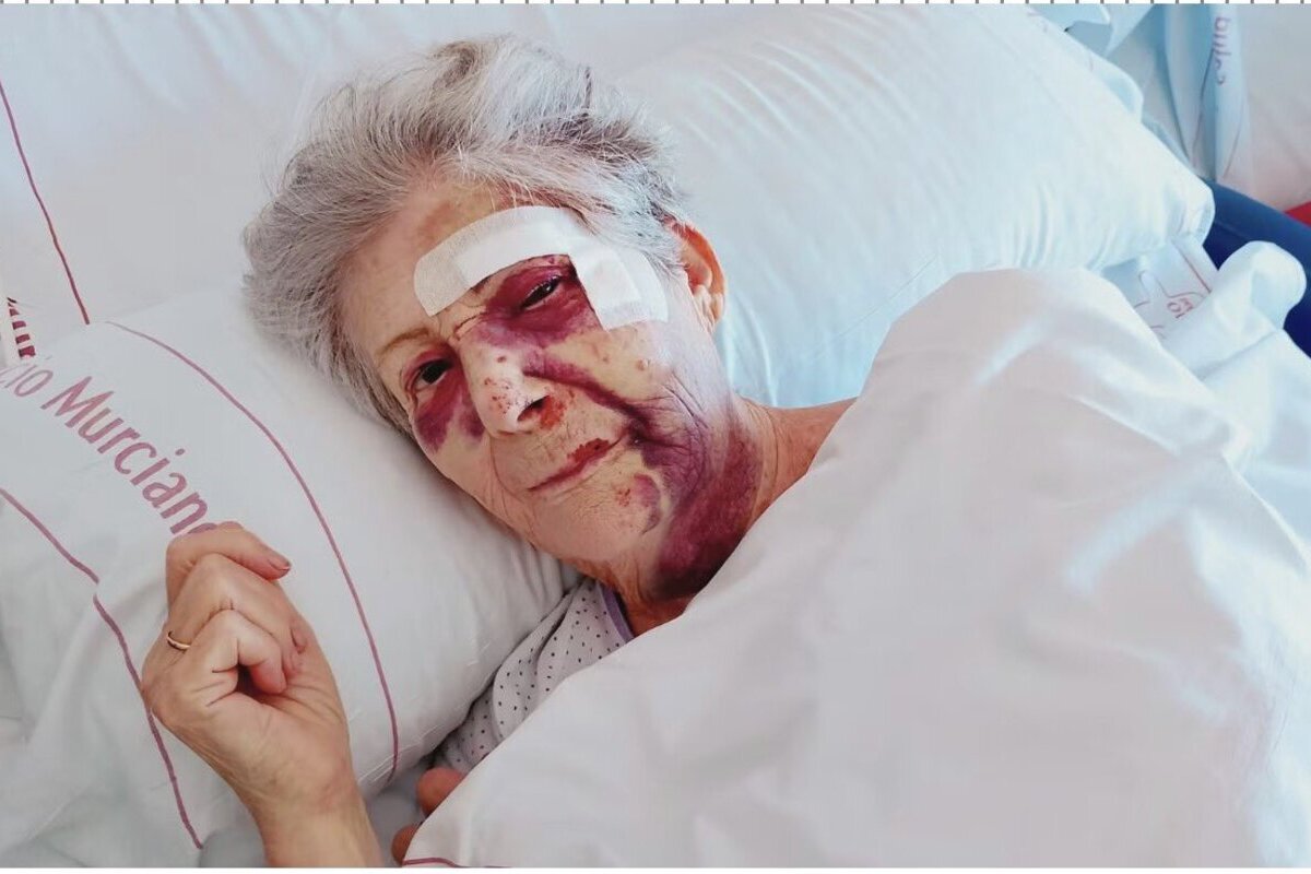 Un inmigrante magrebí destroza la cara a una anciana para robarle el bolso en Santiago de la Ribera (Murcia)