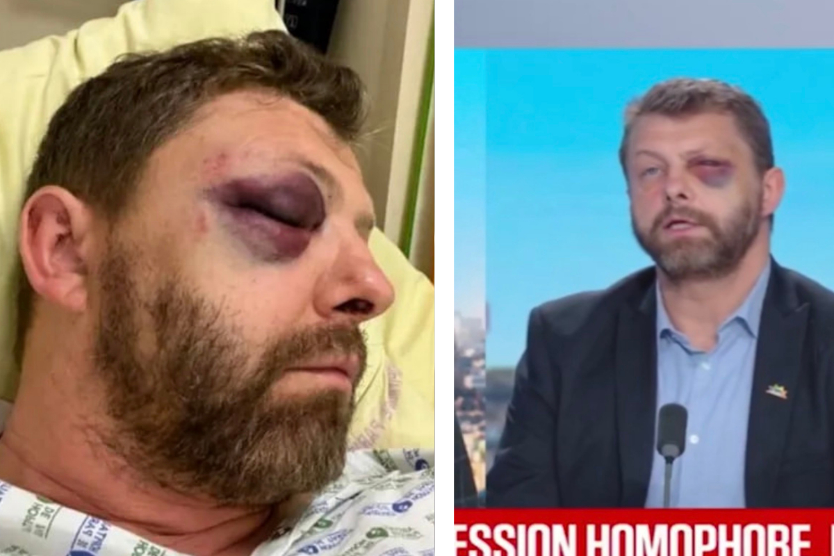 Brutal paliza por parte de un individuo de origen árabe al presidente de la asociación de policías LGBT de Francia: «Te voy a matar»