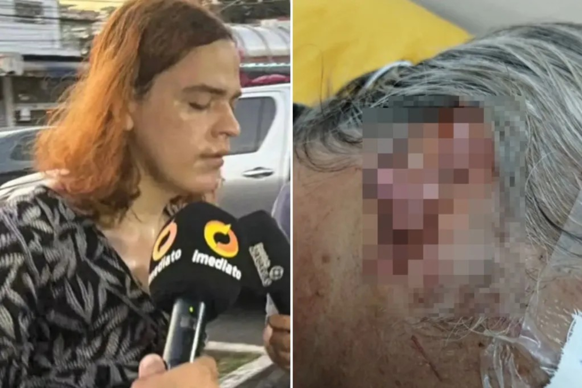 Detenida una trans en Brasil acusada de mutilar ambas orejas, dejar ciego, violar y tratar de matar a su padrastro